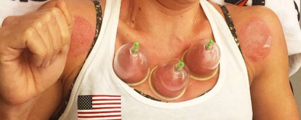 face cupping 1