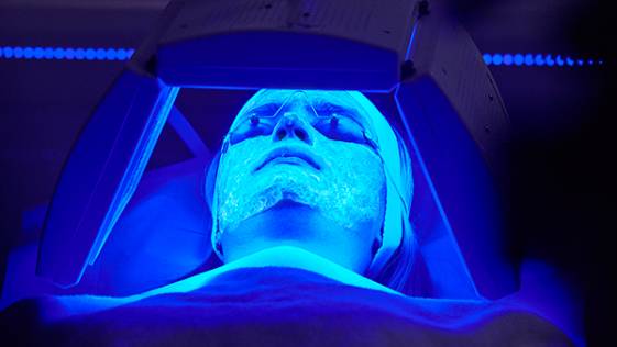 Luz azul piel terapia biofotonica