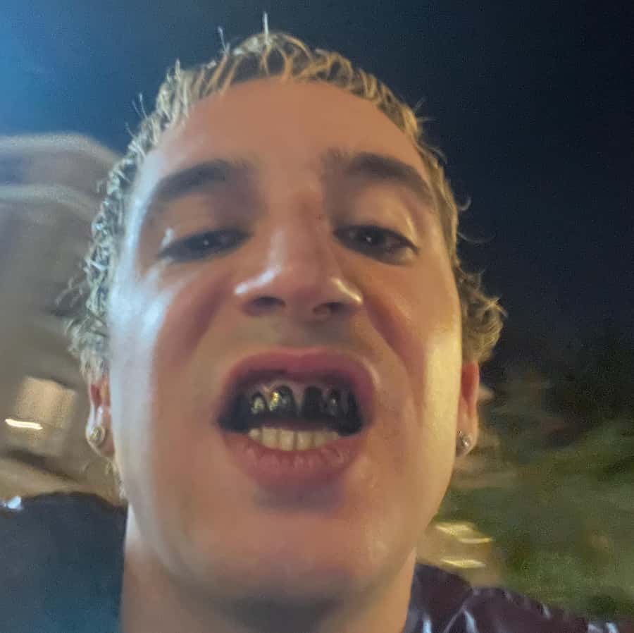 Ralphie Choo con dientes metálicos