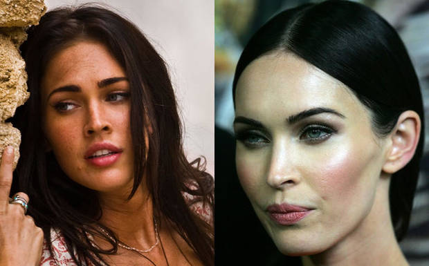 celebrities-post-bisturi-radical megan