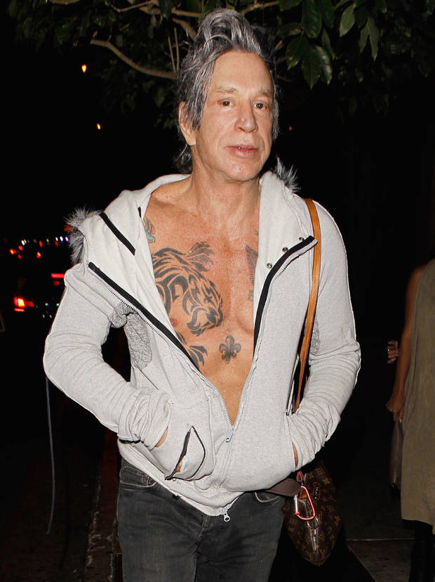 Pete-burns-cirugia-rourke-2