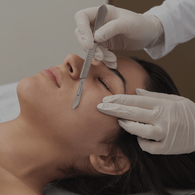 Tratamiento profesional de dermaplaning