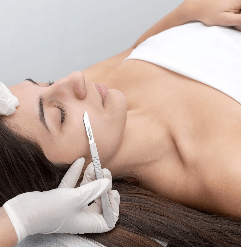 Tratamiento profesional de dermaplaning